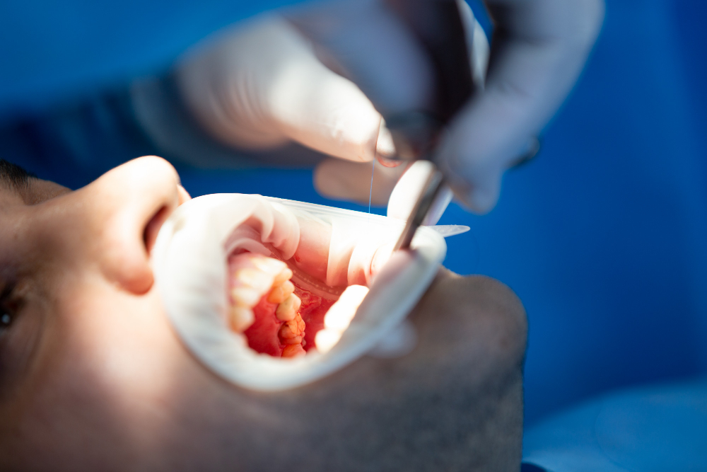 Oral and Maxillofacial Surgery