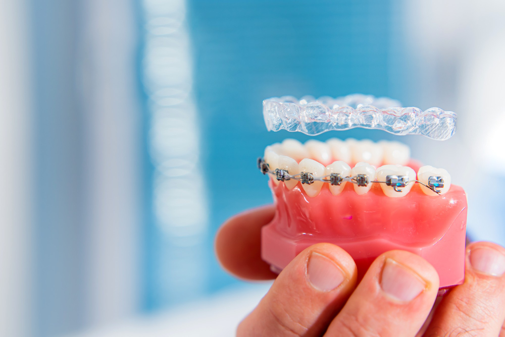 Prosthetic Dentistry