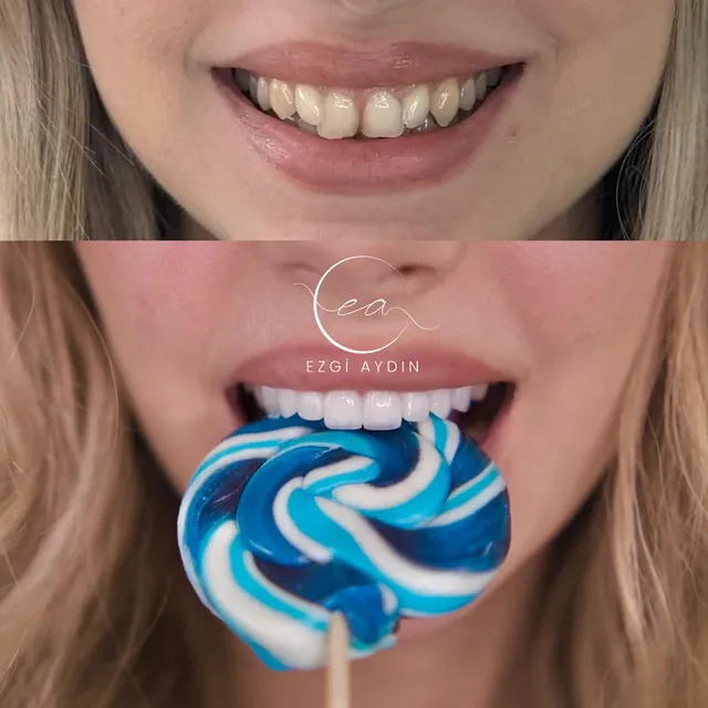 Original before-and-after dental photograph collage 4