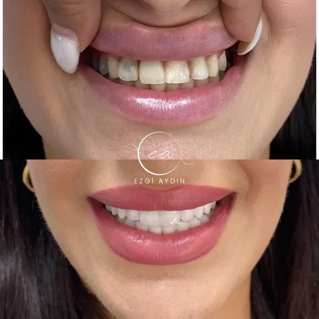 Original before-and-after dental photograph collage 3