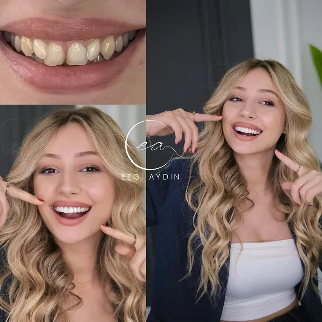 Original before-and-after dental photograph collage 1