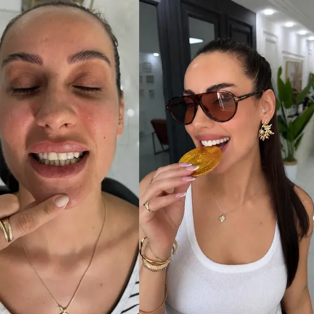Original before-and-after dental photograph collage 5